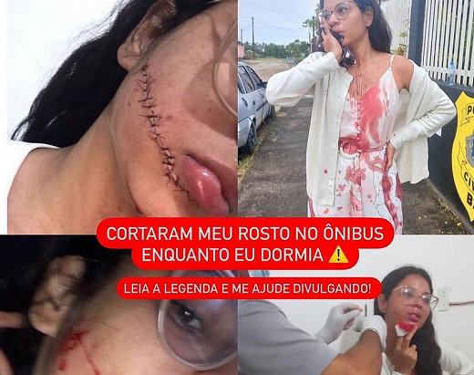 Stefani foi esfaqueada no rosto enquanto dormia em uma viagem de ônibus (Foto: Reprodução)